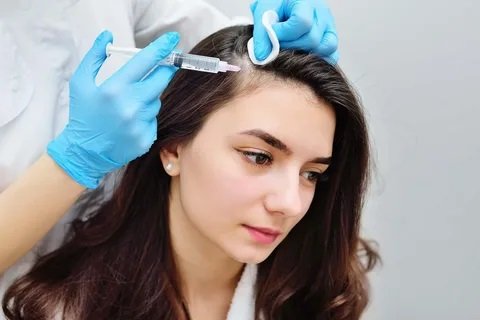 What Are the Pre-Treatment Guidelines for PRP Hair Treatment in Islamabad?